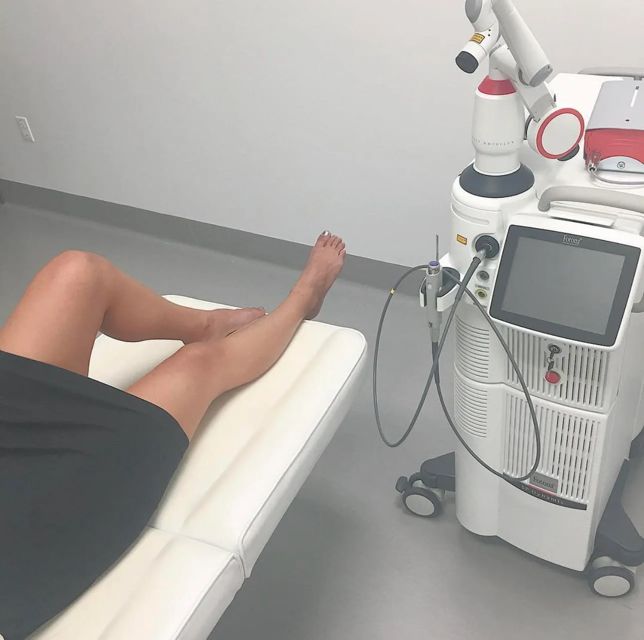 A photo of a woman laying on an examination table. Her legs are exposed and about to receive Fotona laser hair removal. She's wearing a grey dress.